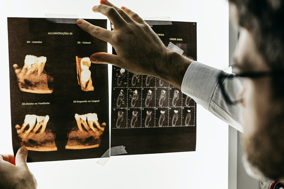 dental-xray