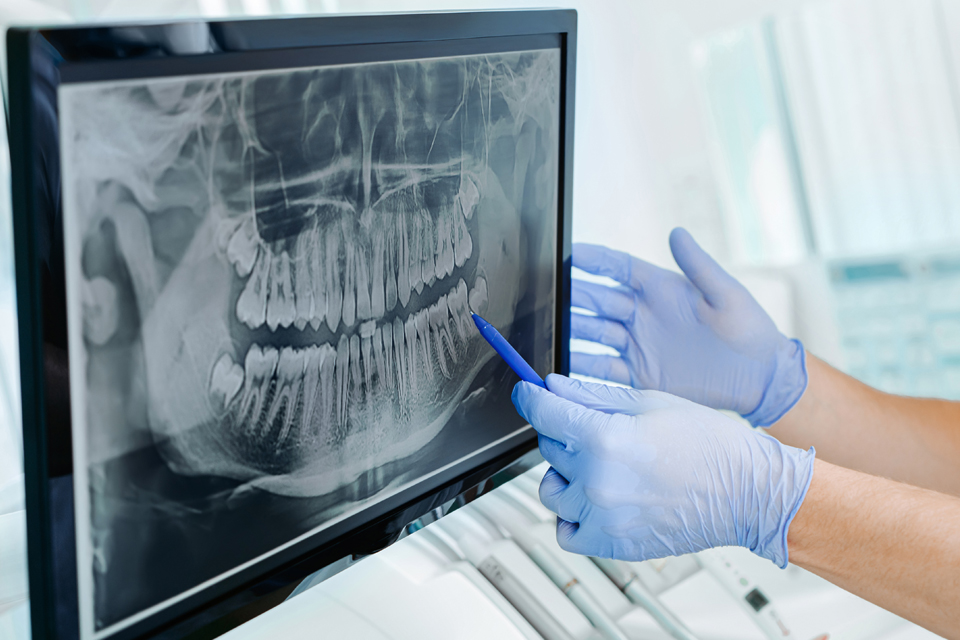 xray-from-dentist
